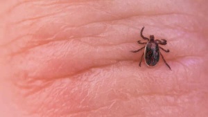 From Fitness Icon to Paralysis: How a Tick Bite Devastated an Athlete's Health – and What You Need to Know