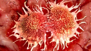 Vitamin C Deficiency Linked to Higher Risk of Stomach, Esophageal, and Lung Cancers: Know the Signs
