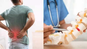 Is it a Slipped Disc? Key Differences in Back Pain Symptoms You Need to Know