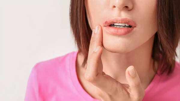 Recognizing persistent, non-healing skin sores