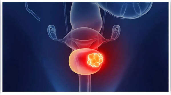 Experiencing pain in the lower back.