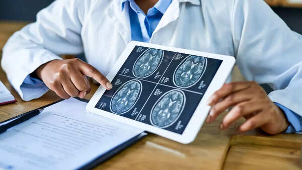 Simplified brain illustration